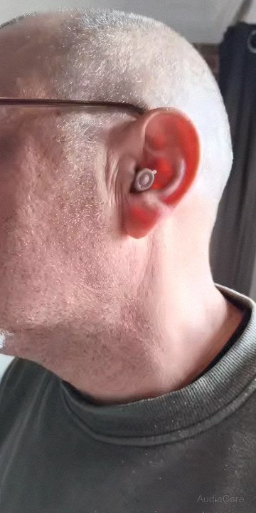 Customer photo